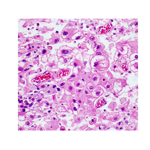 Advanced Stereo Zoom Microscope